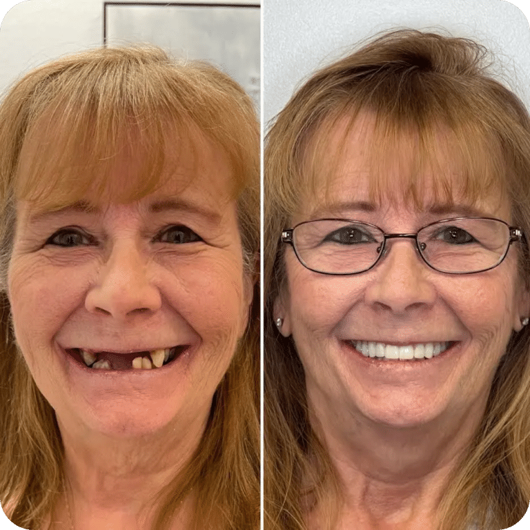 Family & Implant Dentist in Colorado Springs, CO North End Dental