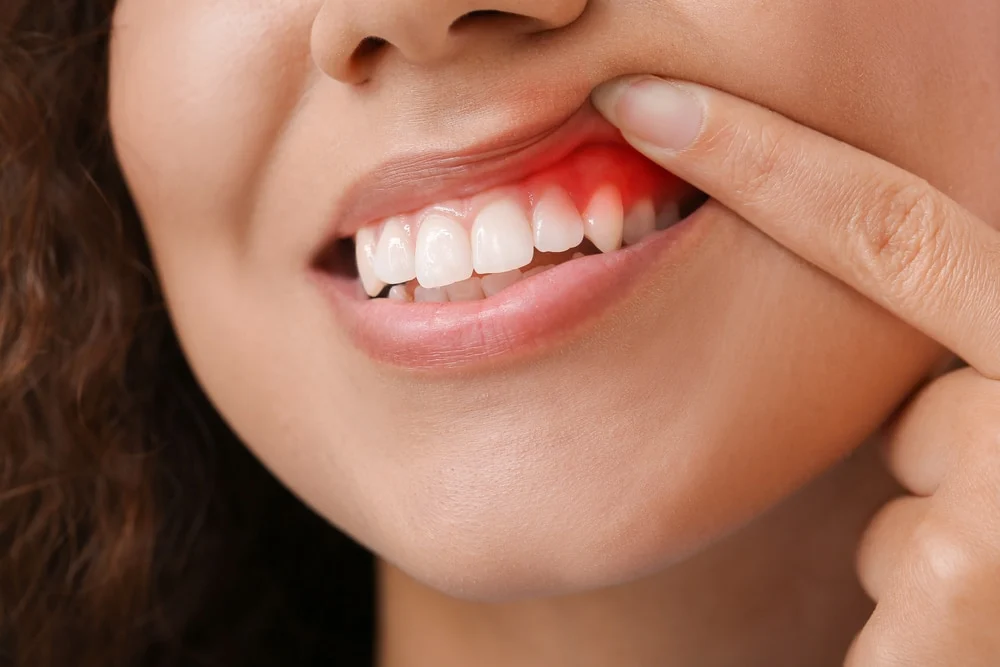 How To Avoid Gum Disease